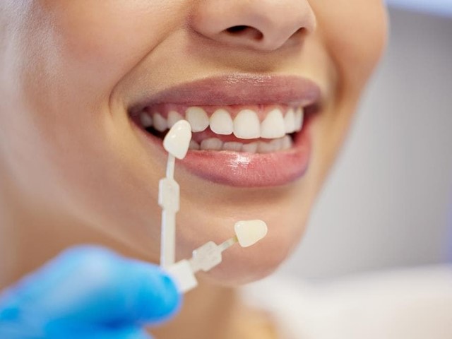 Cales son os beneficios do branqueamento dos dentes profesionais?